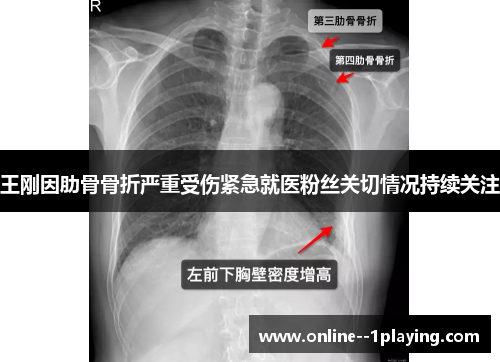 王刚因肋骨骨折严重受伤紧急就医粉丝关切情况持续关注